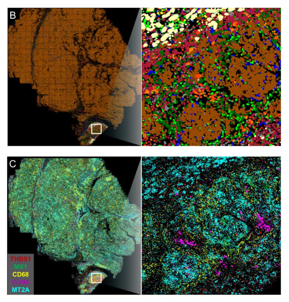 Cell Type Map CosMx SMI Human Liver RNA FFPE Dataset | Bruker Spatial Biology