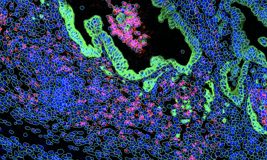 UMass Chan Medical School Spatial Day | Bruker Spatial Biology