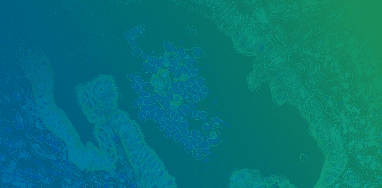 Spatial Debiasing Boston Spatial Biology Roadshow | Bruker Spatial Biology