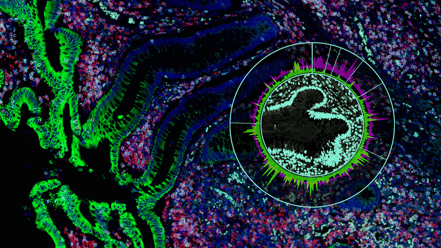 Sample to insight journey with NanoString’s high plex spatial platforms ...