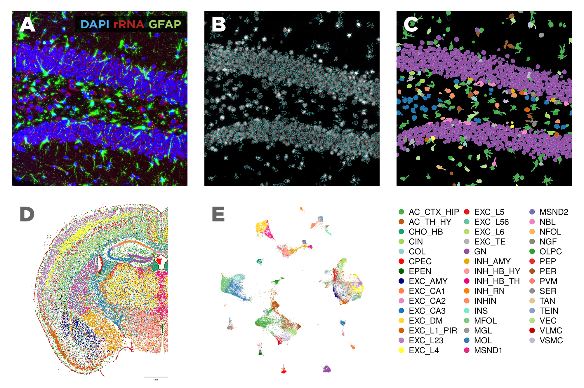 mouse brain dataset analysis Images High Quality Grahic CosMx SMI Mouse Brain FFPE Dataset | Bruker Spatial Biology