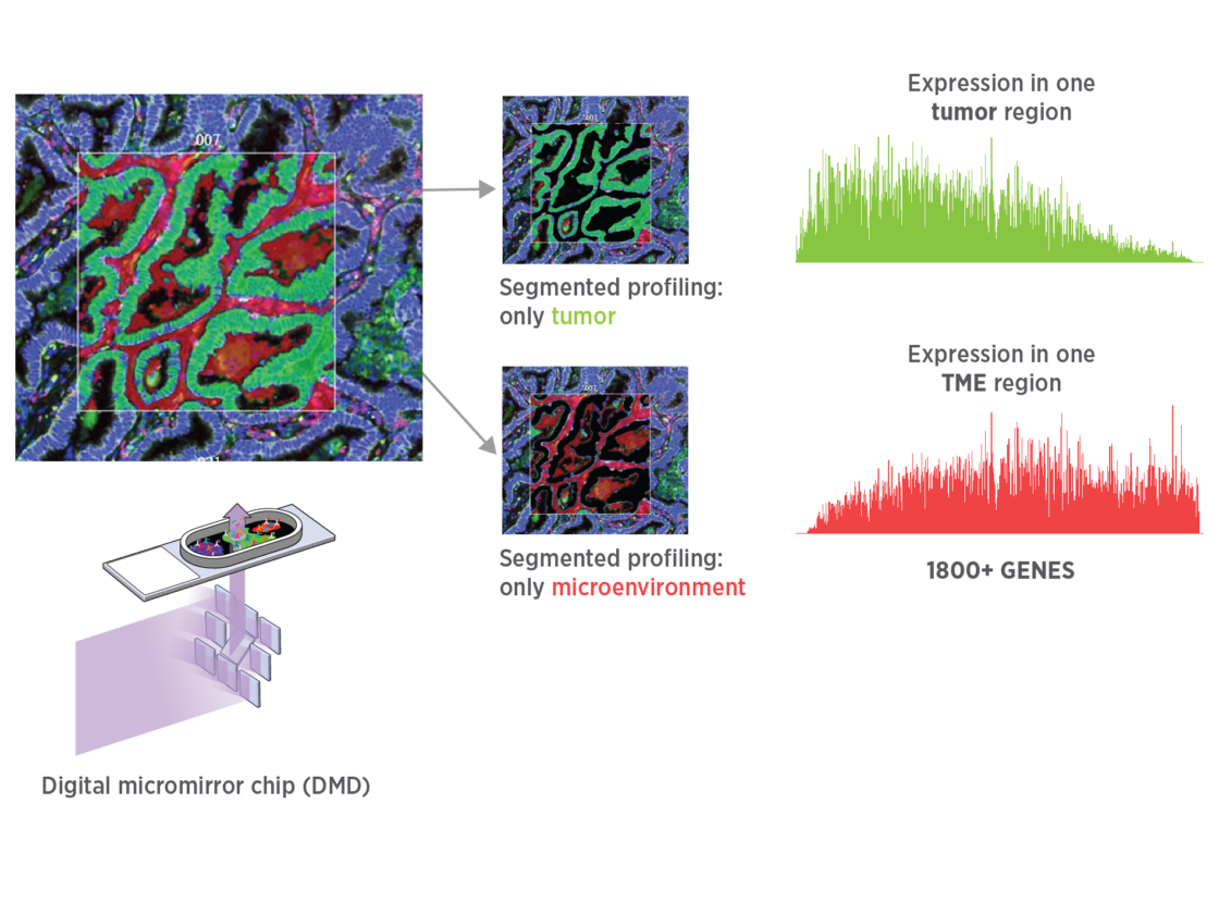 Illustration of GeoMx segmenting of only tumor or only microenvironment