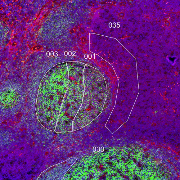 Spatial Multiomics Enabled with GeoMx DSP | Bruker Spatial Biology