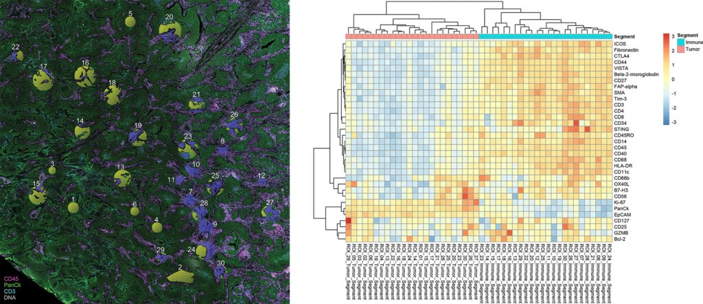 Example tissue image and protein expression diagram demonstrating ROI