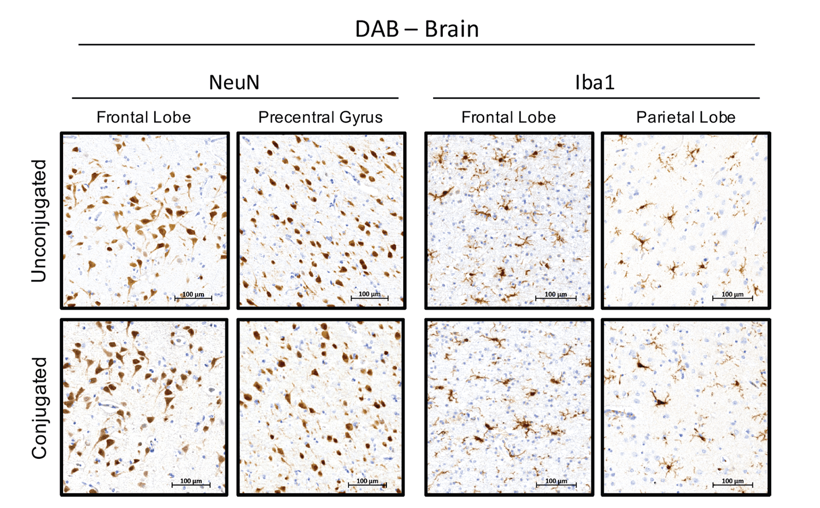 DAB - Brain NeuN and Iba1 images