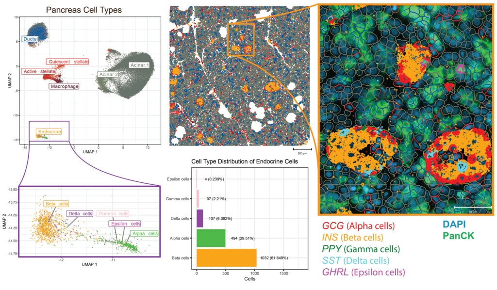 CosMx Human Whole Transcriptome Human Pancreas Dataset visualization overview