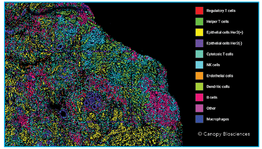 Breast cancer tissue with cell types identified. The quantitative biomarker data facilitates cell type and leukocyte type identification, which can be mapped back to the original tissue to generate spatial insights. Shown above, the same HER2+ breast carcinoma sample, with identified cell types mapped back onto the tissue image to allow for additional spatial interrogation.