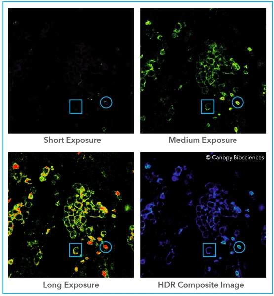 <strong>Precise spatial multiplexing using HDR microscopy.</strong> A human non-small-cell lung carcinoma tissue sample was imaged using a fluorescently labeled antibody targeting surface biomarker CD4. Within each exposure, the color indicates the intensity of light signal, with red indicating that the signal is beyond saturation. The short exposure was the only one to capture a non-saturated image of the cell with the blue circle, while the cell in the blue rectangle remained invisible. The cell in the blue square became visible in the longer exposures, but at the cost of no longer detecting linear signal from the cell in the circle. By overlaying the exposures in the HDR composite image, both cells can be visualized and have quantifiable fluorescence signal at the same time.