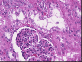 A paraffin section of kidney that has been fixed using neutral buffered formalin