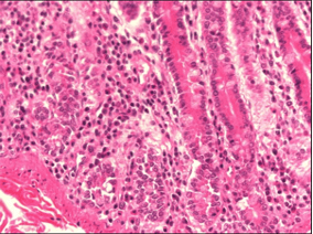 A paraffin section from the mucosa of small intestine that has been fixed in 95% ethanol, a denaturing fixative.