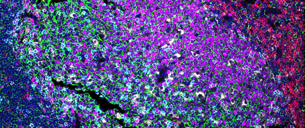 FFPE_Immune_Profiling_Kit