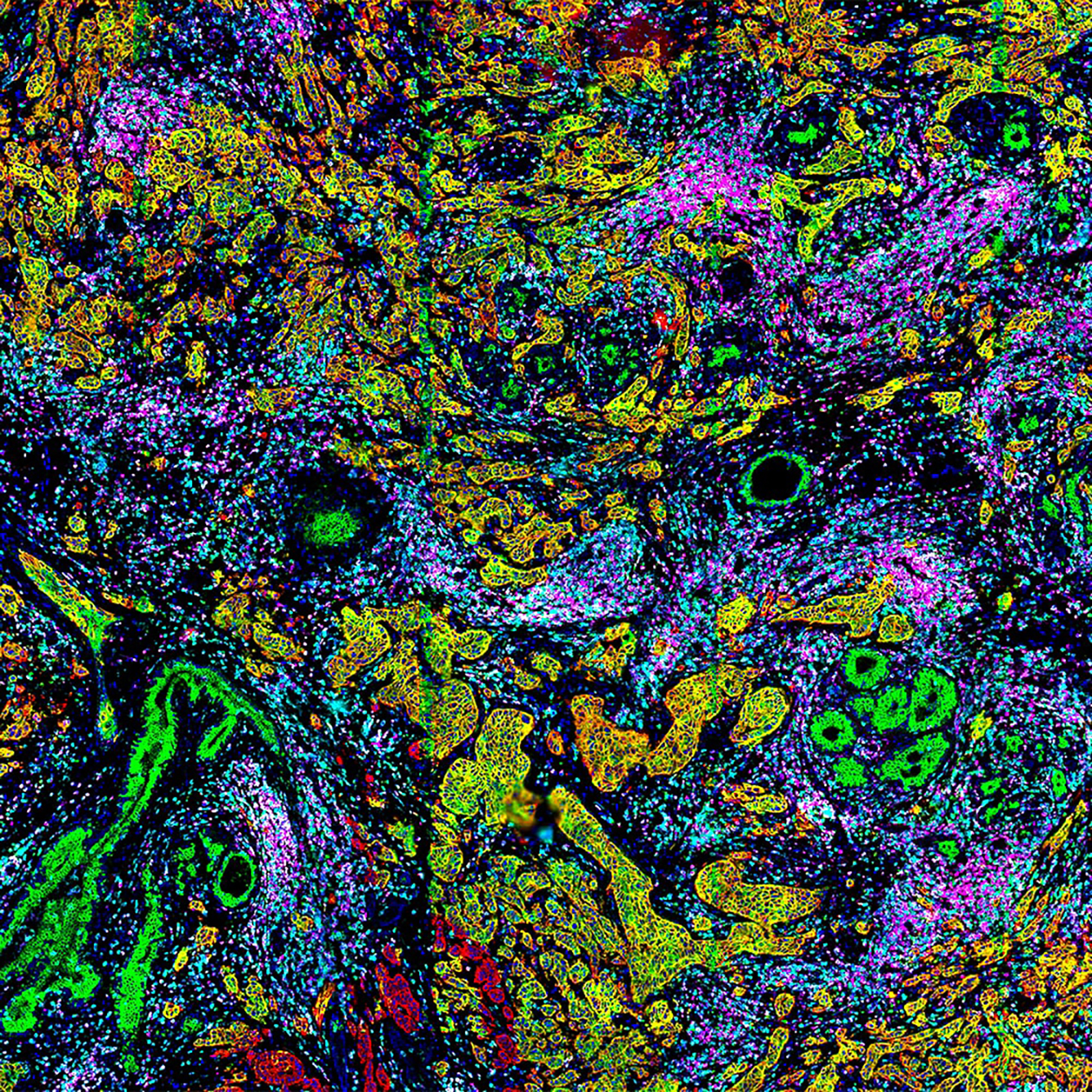 CellScape_Breast_Cancer_Multiplex_Image@2x