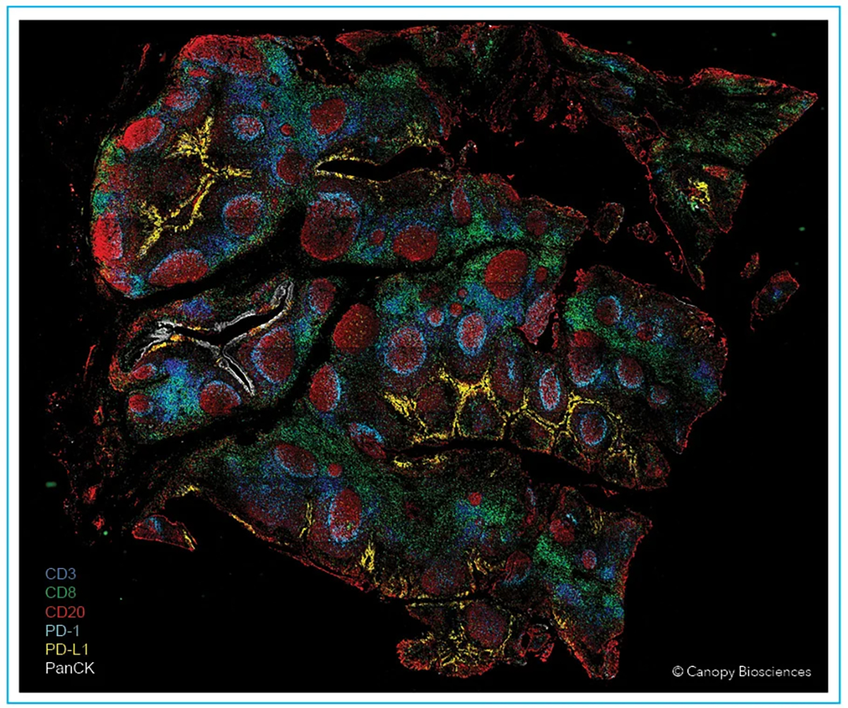 Tonsil-image@2x High resolution image of FFPE human tonsil stained with 14-plex VistaPlex Spatial Immune Profiling Assay Kit, imaged with CellScape Whole-Slide Imaging Chamber. Select biomarkers are displayed as indicated in the legend. The increased scanning area available with Whole-Slide Imaging enables comprehensive analysis of large tissue samples.