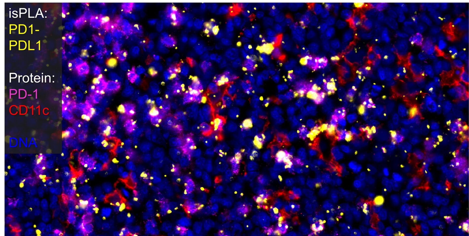 isPLA with VistaPlex 1