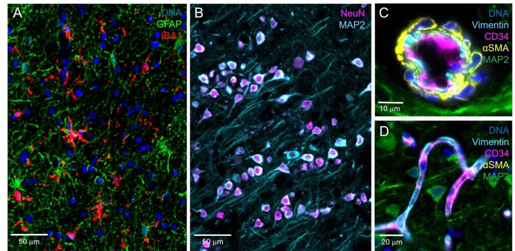 Microscopic views of neuroscience with fluorescently labeled neurons and tissue structure markers.