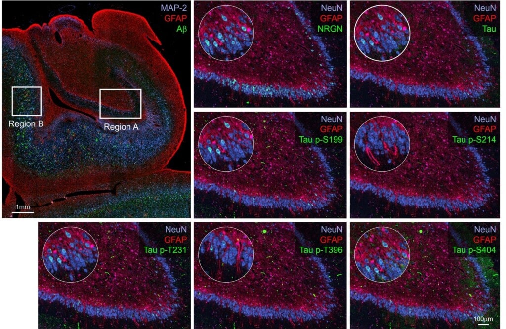 Zoomed-in sections of dentate gyrus brain tissue, stained for different Alzheimer&rsquo;s Disease markers including NRGN, p62, Ubiquitin, and several phosphorylated-Tau proteins.