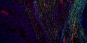 Bruker Spatial Biology Day at Maastricht UMC