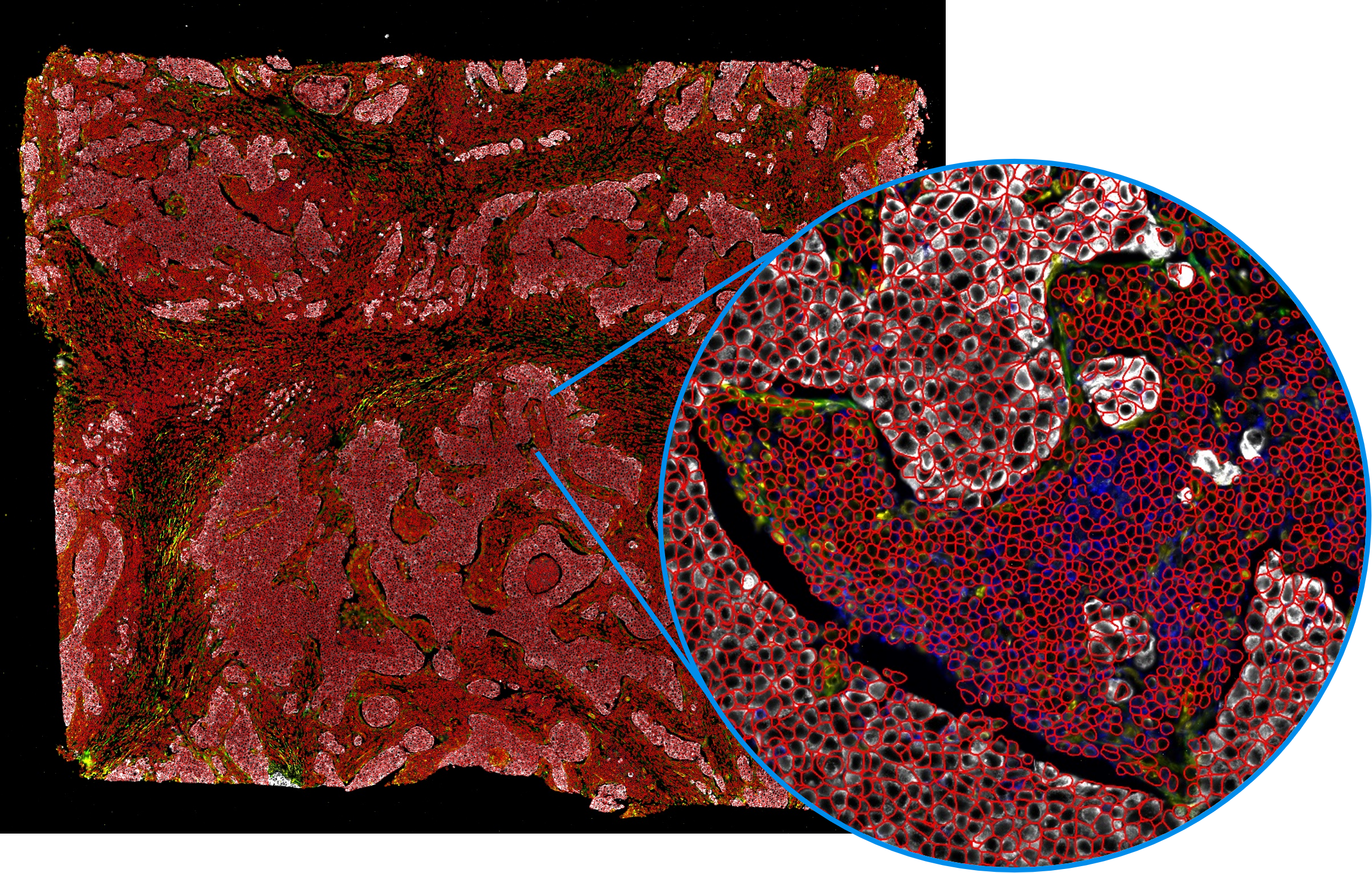 Tissue section stained with multiple markers, with a zoomed-in inset showing precise cell segmentation.