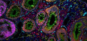 Organoids Are Us 2025