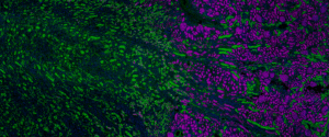 Exploring Bulk and Spatial Multiomics Solutions