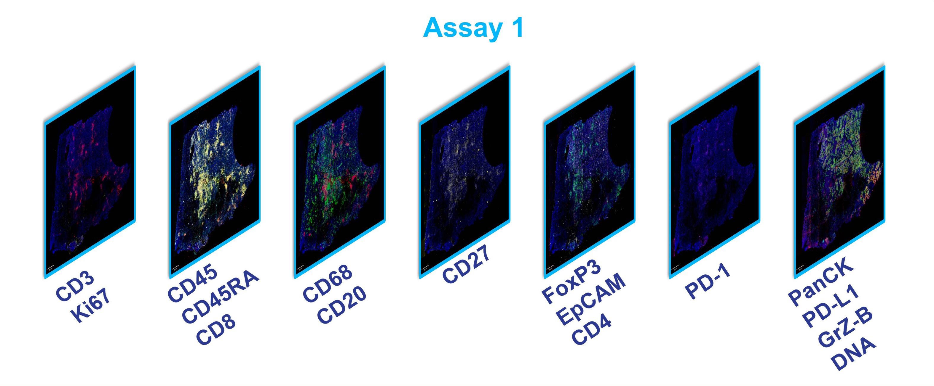 Initial assay for immune profiling covered 16 biomarkers.