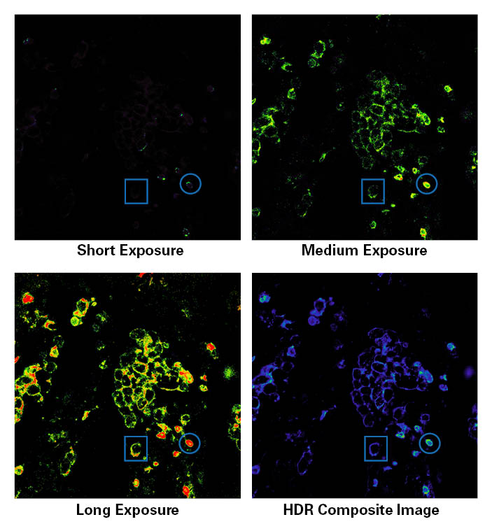 <strong>Precise spatial multiplexing using HDR microscopy.</strong> A human non-small-cell lung carcinoma tissue sample was imaged using a fluorescently labeled antibody targeting surface biomarker CD4. Within each exposure, the color indicates the intensity of light signal, with red indicating that the signal is beyond saturation. The short exposure was the only one to capture a non-saturated image of the cell with the blue circle, while the cell in the blue rectangle remained invisible. The cell in the blue square became visible in the longer exposures, but at the cost of no longer detecting linear signal from the cell in the circle. By overlaying the exposures in the HDR composite image, both cells can be visualized and have quantifiable fluorescence signal at the same time.