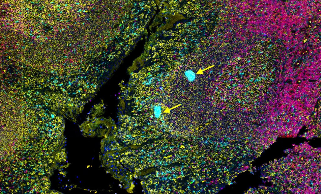 Fluorescent tissue image with large, bright blue blobs, indicating antibody aggregation