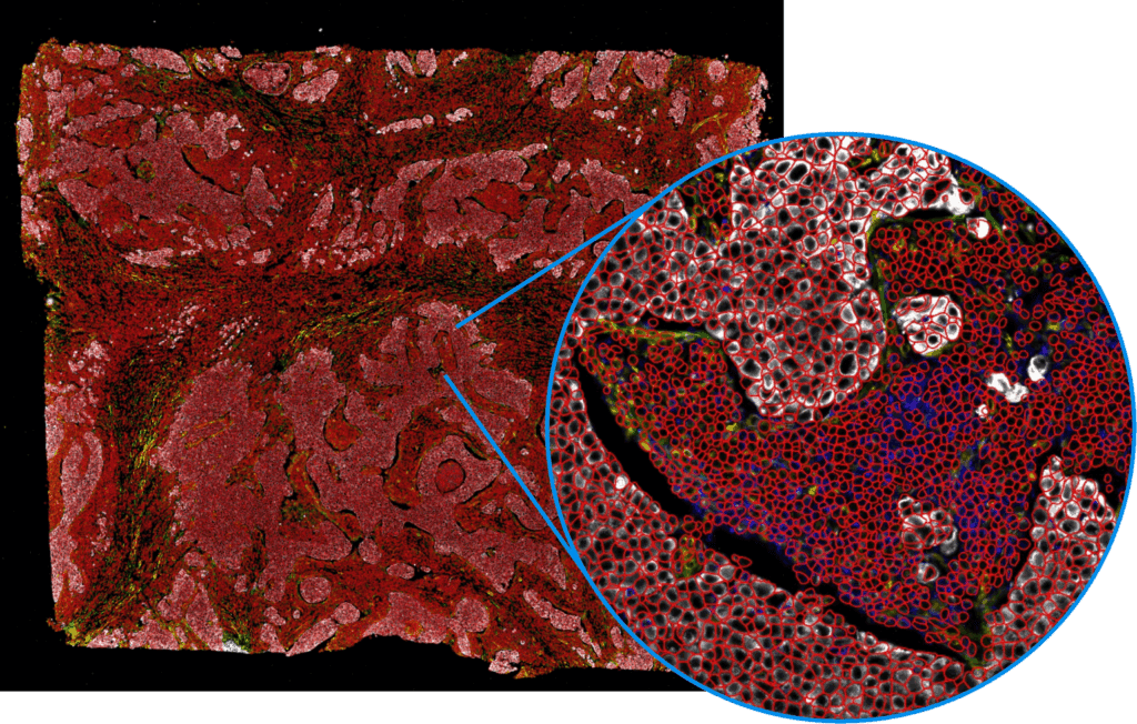 Tissue section stained with multiple markers, with a zoomed-in inset showing precise cell segmentation.