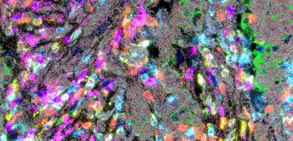 Colorful tissue image captured with CosMx SMI, showing both RNA and protein in the same view.