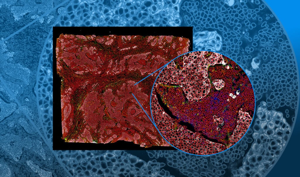 Stained tissue section with zoomed in section showing cell boundaries