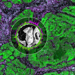 Spatial Transcriptomics
