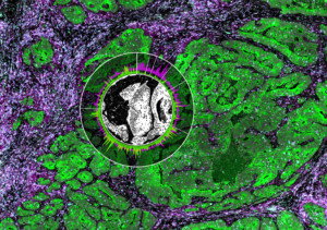 Spatial Transcriptomics