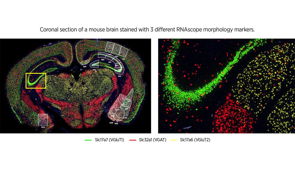 GeoMx Morphology Markers | Bruker Spatial Biology