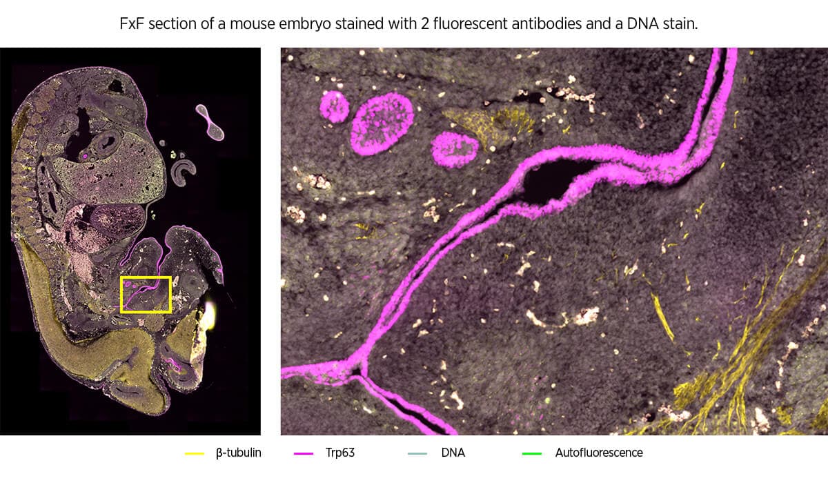 GeoMx Morphology Markers | Bruker Spatial Biology