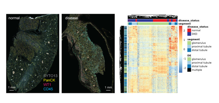 Geomx Dsp Spatial Genomics Overview Nanostring 