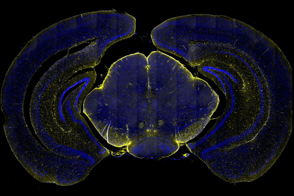 GeoMx DSP Neuroscience Whole Transcriptome Atlas Grant | Bruker Spatial ...