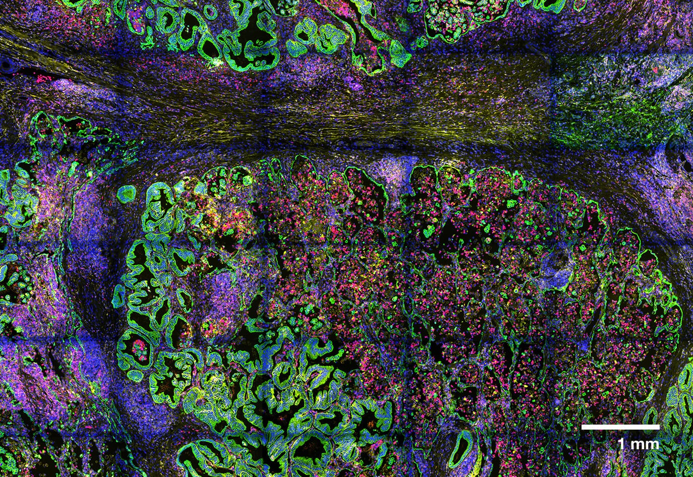 Spatial Proteomics GeoMx Grant for Central and Eastern Europe | Bruker ...