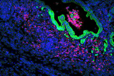 High-resolution RNA imaging of lung tissue. (Graphic: Business Wire)