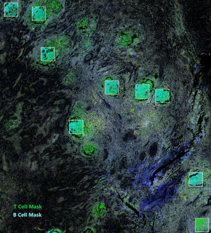 GeoMx DSP Helps to Uncover Role of B cells in Response to Immunotherapy (Photo: Business Wire)