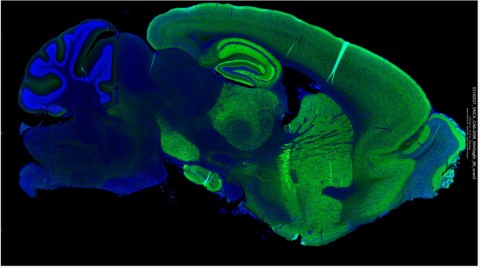 This sagittal section of a normal adult mouse brain, imaged on the Digital Spatial Profiler, is stained for neuronal protein alpha-synuclein (green) and DNA (blue) to illuminate intricate morphological structures for further expression profiling. Alpha-synuclein plays a crucial role in synaptic vesicle trafficking and neurotransmitter release. Accumulation and aggregation of alpha-synuclein is a hallmark of Parkinson&rsquo;s disease and a therapeutic target of interest. (Graphic: Business Wire)