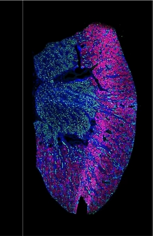 This kidney image represents a 5 &micro;m FFPE tissue section from a 41-year-old man. The sample was visualized with PanCK (epithelial cells), CD10+CD31 (proximal convoluted tubules and endothelial cells), and SYTO 83 (nuclei). The sample was profiled on the GeoMx, using the Human Whole Transcriptome Atlas (WTA) assay. (Photo: Business Wire)