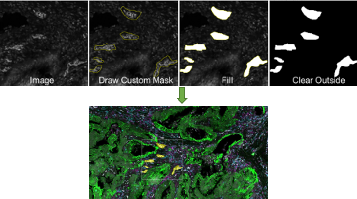 Segmentation and masking at work with GeoMx: now the user can see the molecular conversation between cells